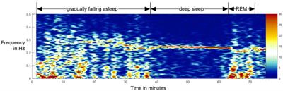 Heart Rhythm Analyzed via Shapelets Distinguishes Sleep From Awake